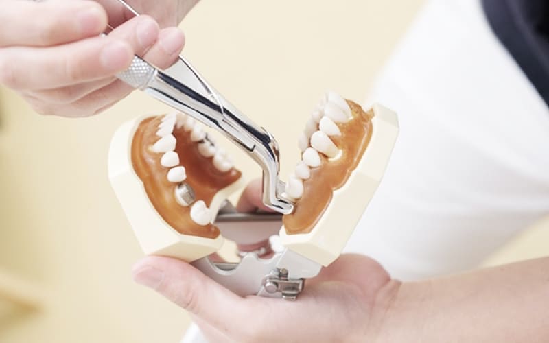 親知らずイメージ