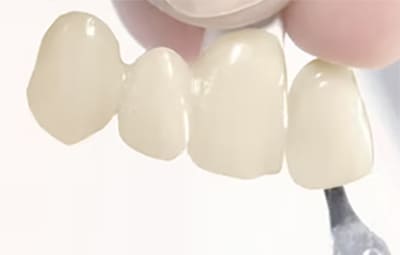 ジルコニアクラウン（完成）